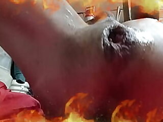 UNA INSERCION EXTREMA DEL GLOTON